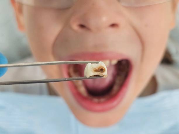 Best Orthodontic Emergency Dentist in Gordonsville, TN